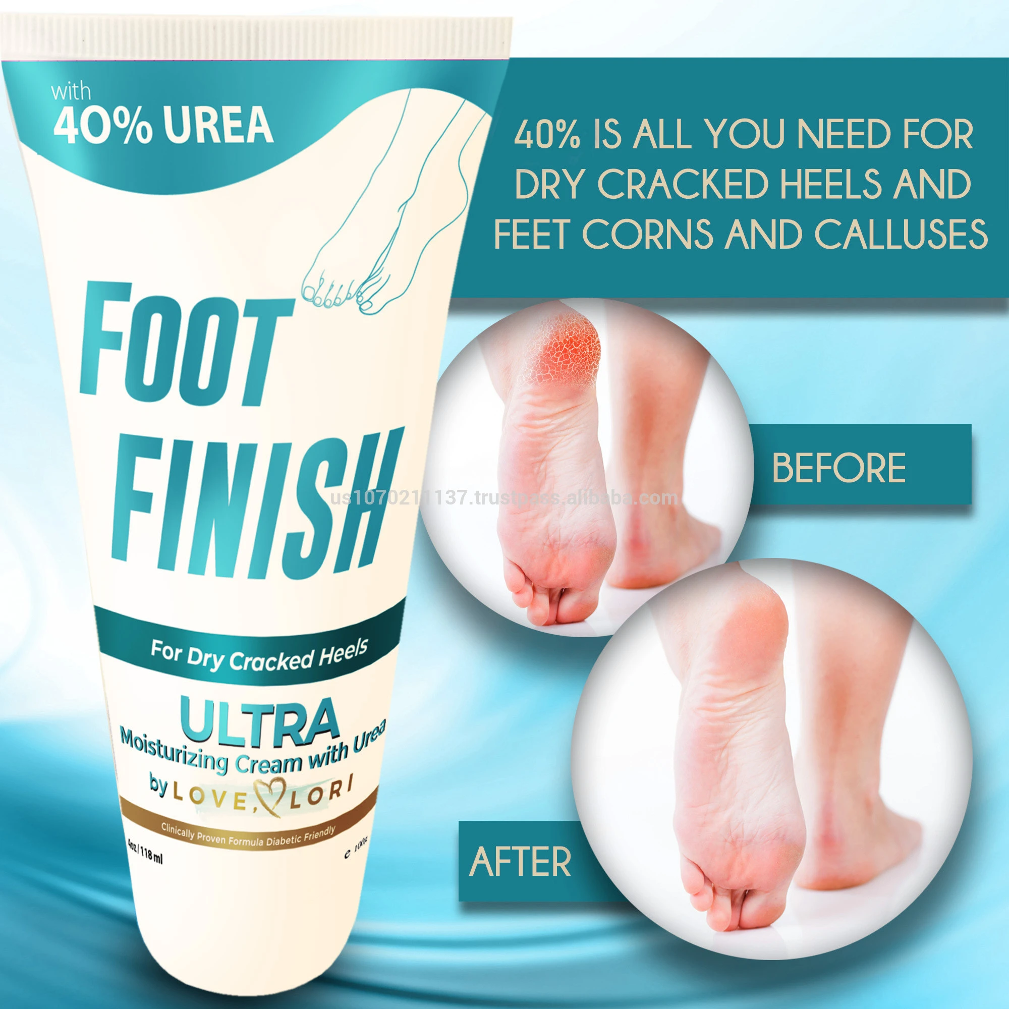 Foot cream for cracked feet - Urea Cream 40%