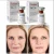 Import sculptra Original Anti-Aging PLA Plla Aesthefill 200mg New Generation Facial Wrinkle Filler Plla from China