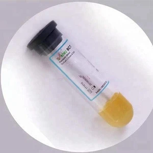 High qualty and lower price glass prp tube acd sodium citrate gel medic kit test For Medicine