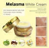 OEM Melasma White Face Cream