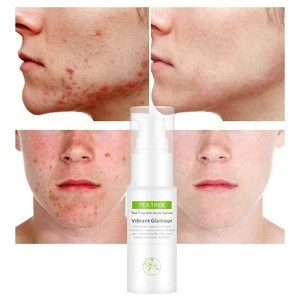 VIBRANT GLAMOUR Organic Tea Tree Face lotion Oil Control Acne Shrink pores natural oil Facial Toner