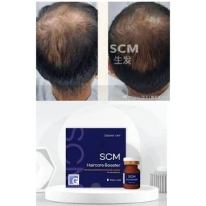 Scm Hair Booster Stimulates Rapid Hair Growth, Good News for Hair Loss Sufferers Dr. Cyjhairfiller Aape