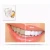 Import Dentist Care Teeth Whitening Pen Non Peroxide Teeth Whitening Gel Pen from China