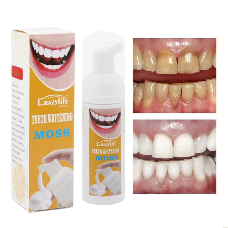 Hot Selling Teeth Cleaning Mousse Fresh Breath Tooth Stains Remove Oral Cleaning Foam Teeth Whitening Products