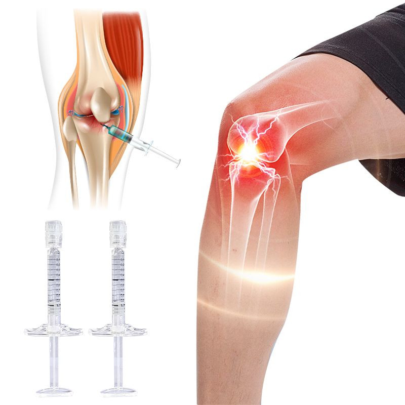 Buy Painless Joint Hyaluronic Acid Gel Filler Injection For Arthritis ...