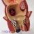 Import Human anatomy model digestive system pathological model of the rectum from China