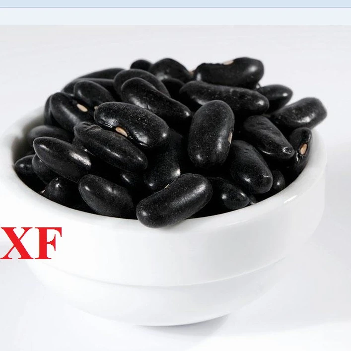 wholesale kidney bean high quality chinese White/Red/Black/Lignt speckled/purple speckled kidney beans