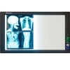 LED Medical X-Ray film viewer,negatoscope LED slim view box