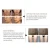 Import 2020 New Arrival RF Skin Machine RF Skin Rejuvenation Wrinkle Removal Slimming Machine Body Shaping Beauty  Thermagic Equipment from China