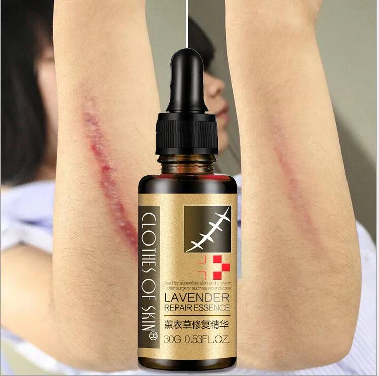 Lavender Repair Essence for Scar Removal, Stretch Mark Massage Oil for Pregnant Women, Hyaluronic Acid Moisturizing Acne Oil