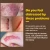 Import VIBRANT GLAMOUR Crocodile Repair Scar Gel Removal Scar Acne Cream Treatment Marks For Face Body Pigmentation Corrector Skin Care from China