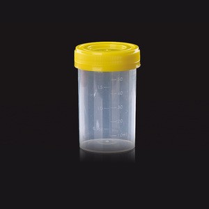 50 ml Medical Sterile Container Sample Disposable Urine Cup With Lid