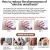 Import Electronic Meridian Laser Acupuncture Massage Instrument Healthcare And Facial Beautification For Face Lift Effect &amp; Pain Relief from China