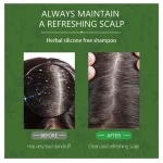 Oem/Odm Hair & Scalp Shampoo Healthy Herbs Clean And Remove Dandruff Shampoo For Rebonded Hair Shampoo To Grow Your Hair