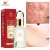 Import Acne removing essence serum Organic Skin Care Products Acne Scars Bio Essence Scar Removal EGF Serum from China