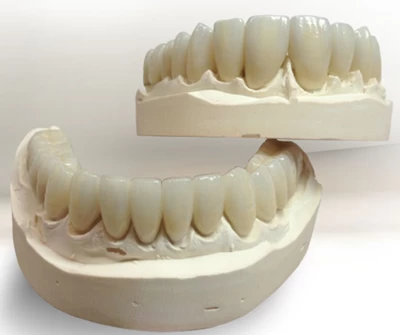 Buy High Durability Cad Cam 3d Printing Temporary Crowns Durable Resin ...