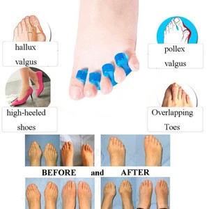 1Pair Toe Separators Gel Toe Separator & Toe Stretcher for Yoga Walking and Dancing for Women and Men