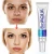Import OEM 30g Bioaqua Best Pimples Removal Face Acne Treatment and Anti Acne Cream from China
