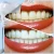 Import Hot Products Top 20 Dental Smile Strips Non Peroxide Teeth Whitening Strips from China