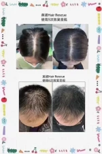 Hair growth spray