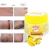 20g Foot Anti-Drying Crack Cream Exfoliating Dead Skin Remover Mask Hand Foot Care Moisturizing Cream