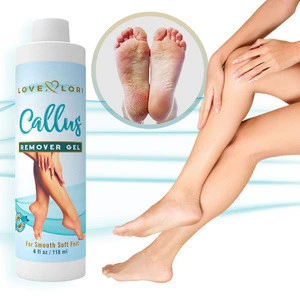 China made utterly effective Safely exfoliate - Callus Gel Remover