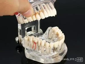 Dental School Teaching Use Removable Resin Teeth Implant Model