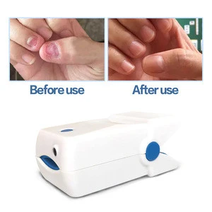 Efficient Cure for Nail Fungus Laser Treatment Device for Ringworm Nails Cleaning Therapy Equipment