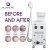 Import Good quality  ! Multifunction Skin Care Beauty Equipment IPL E Light RF laser machine from China