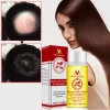 MeiYanQiong Hair Growth Essential Oil Ginger Oil Dense Hair Fast Grow Shampoo Anti-Hair Loss Treatment Repair  Fluid 20ml