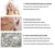 Import Top-Selling Viss IPL +  RF Skin Rejuvenation Package for skin lifting and reduction in fine wrinkles from South Korea