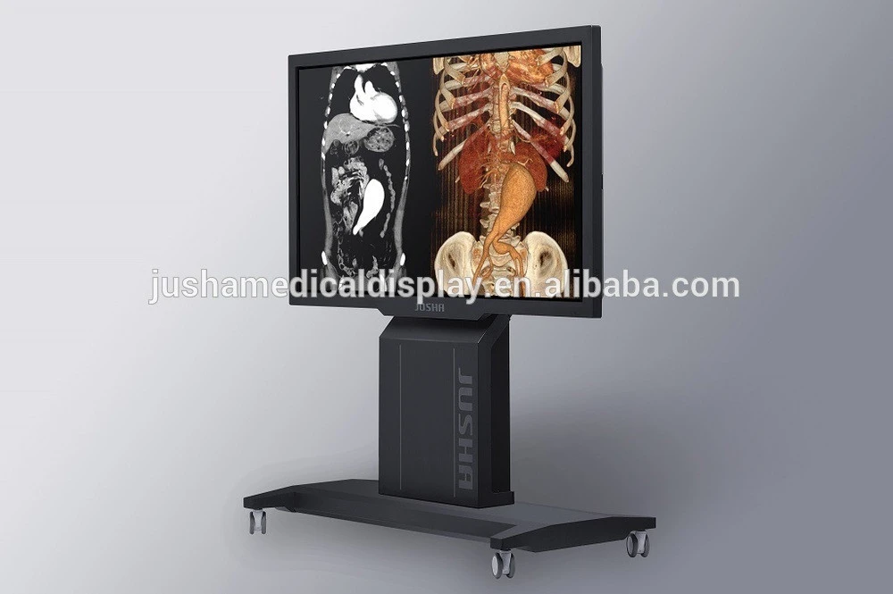 (JUSHA-SUPER84T-AIO) Medical X-ray Equipments &amp; Accessories analyzer machine monitor