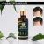 Import Private Label Anti Loss Hair Care Products Natural Ginger Hair Growth Oil Treatment from China