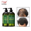 Wholesale Headen Shoulder Shampoo Private Label Shampoo And Conditioner Hair Treament Shampoo