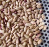 Xinjiang Pinto Beans /LSKB / Cranberry Beans / Mottled Xinjiang LSKB