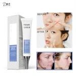 Best selling organic acne gel best acne scar care cream