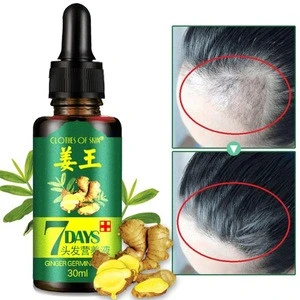 Ginger Germinal Hair regrowth Essential Oil Hair Loss Treatment For Men And Women Chinese herbal strengthen hair drop shipping