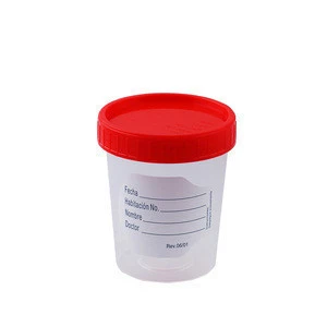Medical consumables 100ml urine container with screw cap