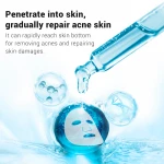 BREYLEE rose water face mask hydrating face masks