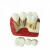 Import HOT SALES dental implant model medical restoration model Manufactory implant teeth model in science from China