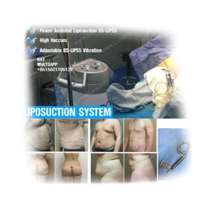 Surgical Instruments For Liposuction Laser Liposuction Machine Liposuction Syringe / Weight loss