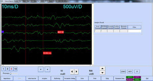 Buy 2/4 Channels Emg / Ep Machine --- Clinical Analytical Instruments ...