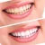 Import 28Pcs/14Bag 3D WhiteningTeeth Whitening Strips Oral Hygiene Care Double Elastic Teeth Strips Whitening Dental Bleaching Tools from China