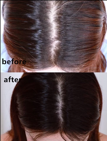 Best Ginger Hair Growth  Oil Private Label Anti-Hair Loss Hair Growth treatment serum