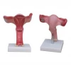 Magnified Uterus Model Hospital school medical teaching anatomical model BC1115-36A