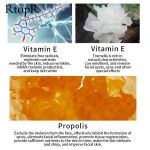 RtopR Propolis Repair Acne Brightening Serum Acne Scar Spots Cleaning Serum Shrink Pores Eliminates Acne Treatment Oil control