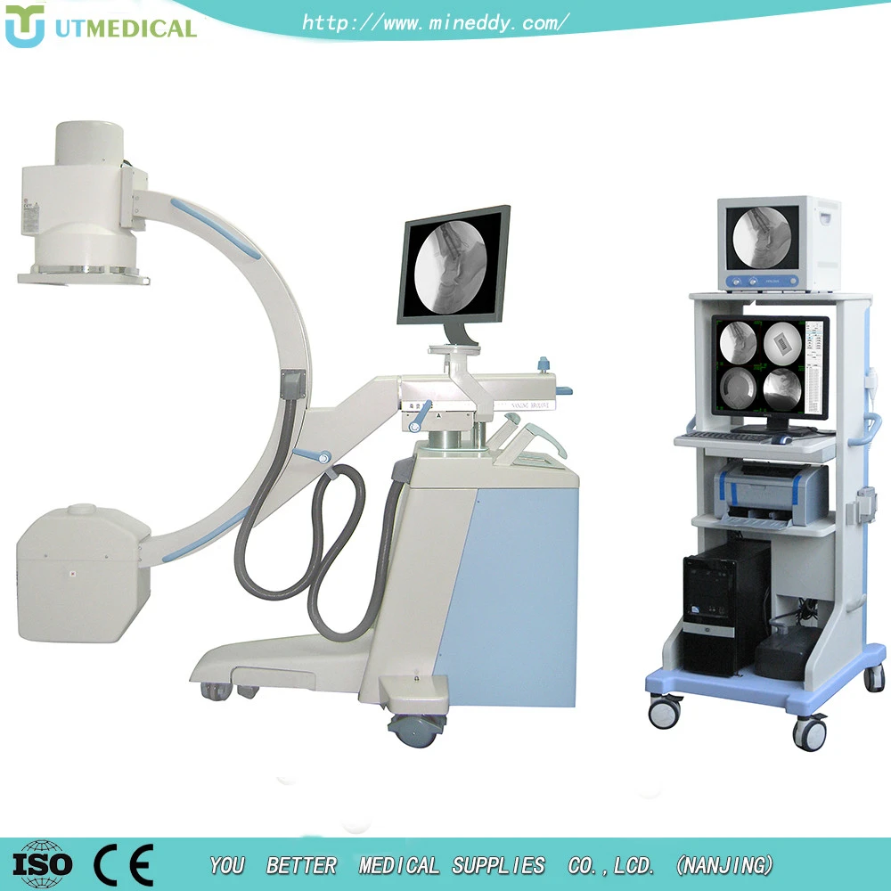 High Frequency mri equipment price with c-arm