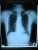 Import Medical X-Ray Film Blue Sensitive (35x43cm) from China