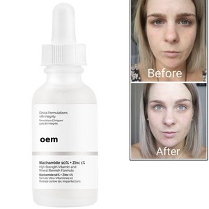 OEM 30ML Niacinamide 10% + Zinc 1% Face Serum Vitamin B3 Whitening Oil Balance Reduce Blemishes Brighten Skin Color Essence