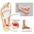 Import Plantar FXT Night Splint Plantar Fasciitis Medical Ankle Support Treat Heel Pain Best Foot Pain Relief Orthosis Health Products from China